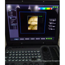 Medical Equipment 3D Image Laptop Portable Color Doppler Pregnancy Diagnostic Ultrasound